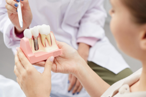 Dental Implants vs Bridges