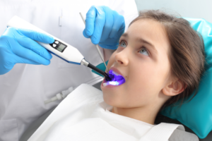 Laser Dentistry in Dubai