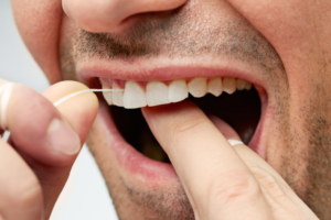 Why Flossing is Mandatory