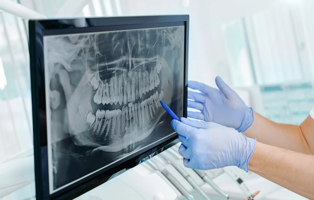 Dental Panoramic X-Ray in Dubai