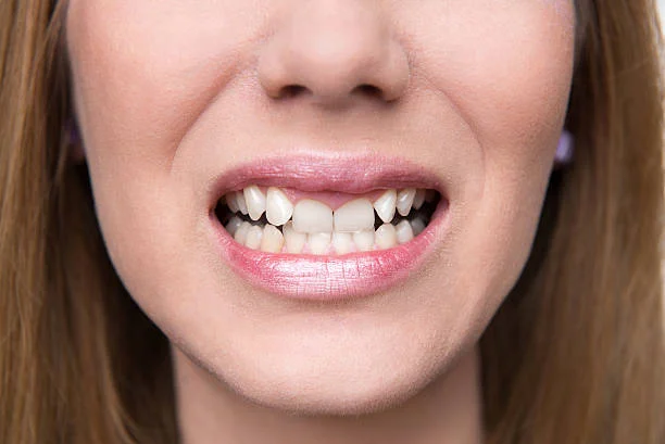 Hollywood Smile in Dubai